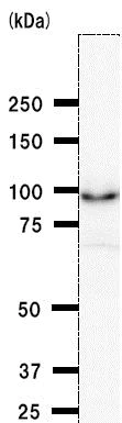 Western blot - Anti-BRD3 antibody [2088C3a] (AB50818)