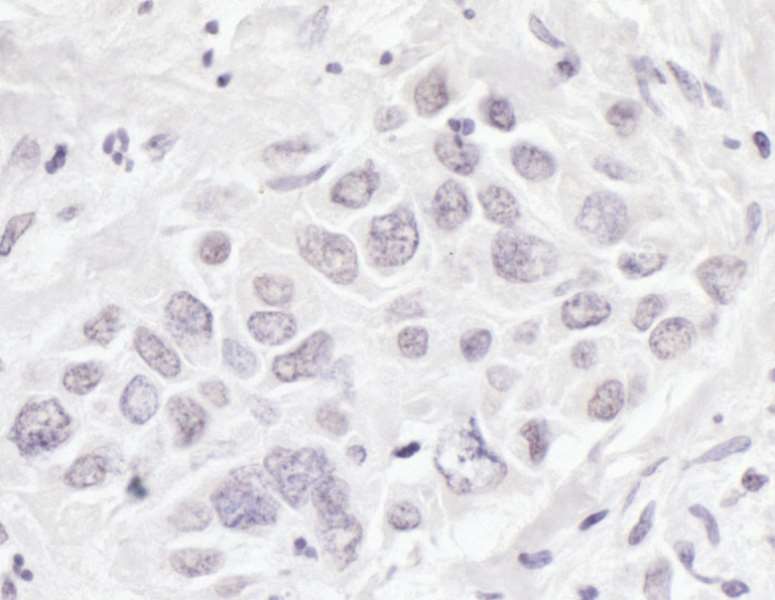 Immunohistochemistry (Formalin/PFA-fixed paraffin-embedded sections) - Anti-BRD3 antibody (AB264294), expandable thumbnail