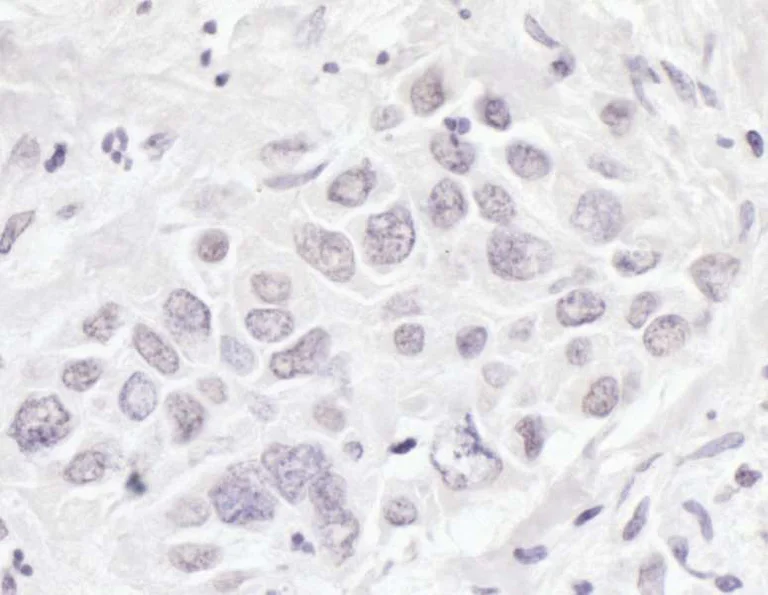 Immunohistochemistry (Formalin/PFA-fixed paraffin-embedded sections) - Anti-BRD3 antibody (AB264294)