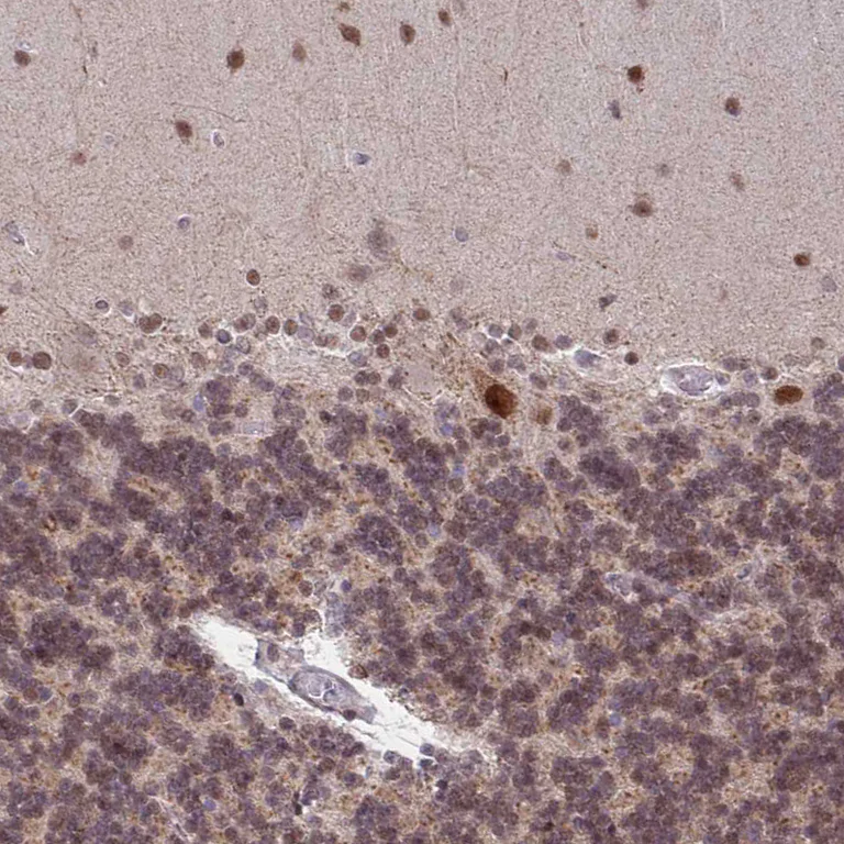 Immunohistochemistry (Formalin/PFA-fixed paraffin-embedded sections) - Anti-BRD3 Antibody (AB327237)