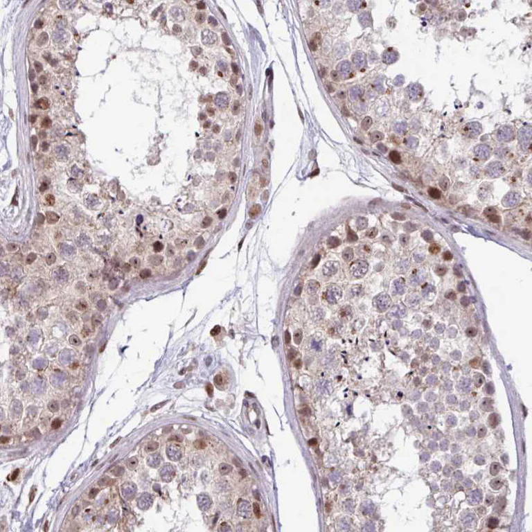 Immunohistochemistry (Formalin/PFA-fixed paraffin-embedded sections) - Anti-BRD3 Antibody (AB327237)