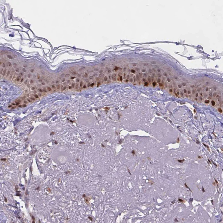 Immunohistochemistry (Formalin/PFA-fixed paraffin-embedded sections) - Anti-BRD3 Antibody (AB327237)