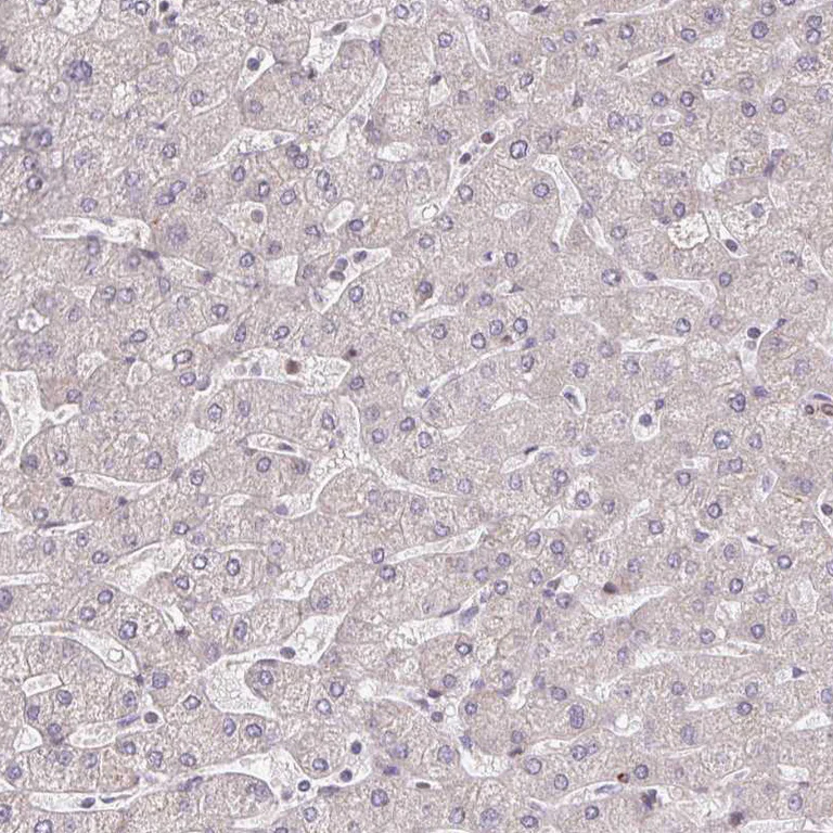 Immunohistochemistry (Formalin/PFA-fixed paraffin-embedded sections) - Anti-BRD3 Antibody (AB327237)