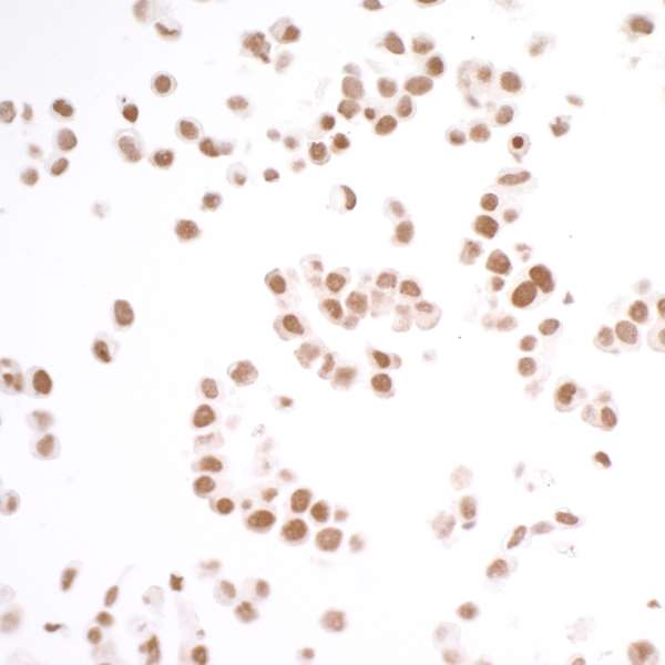 Immunocytochemistry - Anti-BRD3 antibody [BLR069G] (AB264420), expandable thumbnail