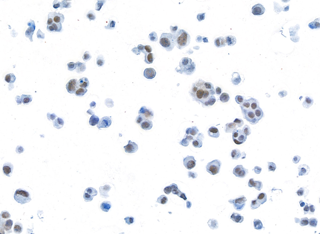 Immunocytochemistry - Anti-BRD3 antibody [BLR069G] (ab264420), expandable thumbnail