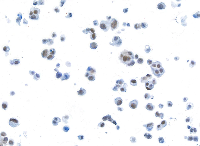 Immunocytochemistry - Anti-BRD3 antibody [BLR069G] (AB264420)