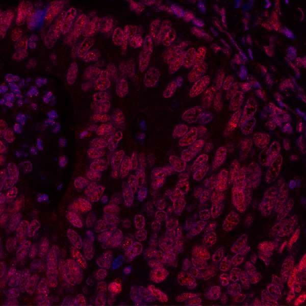 Immunohistochemistry (Formalin/PFA-fixed paraffin-embedded sections) - Anti-BRD3 antibody [BLR069G] (AB264420), expandable thumbnail