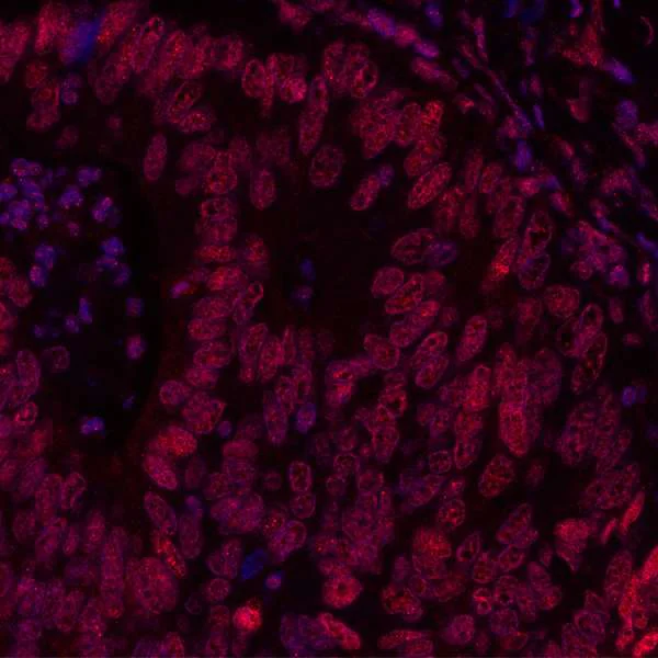Immunohistochemistry (Formalin/PFA-fixed paraffin-embedded sections) - Anti-BRD3 antibody [BLR069G] - BSA free (AB272081)