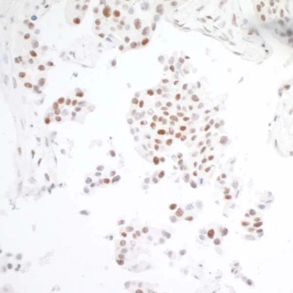 Immunohistochemistry (Formalin/PFA-fixed paraffin-embedded sections) - Anti-BRD3 antibody [BLR069G] - BSA free (AB272081)