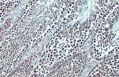 Immunohistochemistry (Formalin/PFA-fixed paraffin-embedded sections) - Anti-BRD3 antibody - C-terminal (AB228936)