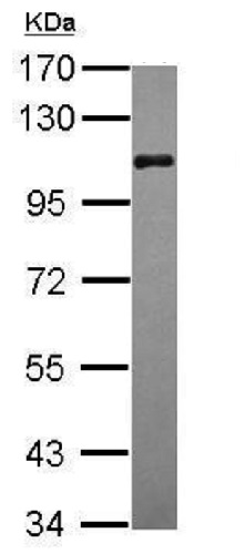 Western blot - Anti-BRD3 antibody - C-terminal (AB228936), expandable thumbnail