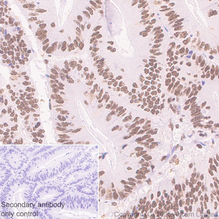 Immunohistochemistry (Formalin/PFA-fixed paraffin-embedded sections) - Anti-BRD3 antibody [EPR30249-10] (AB325539)