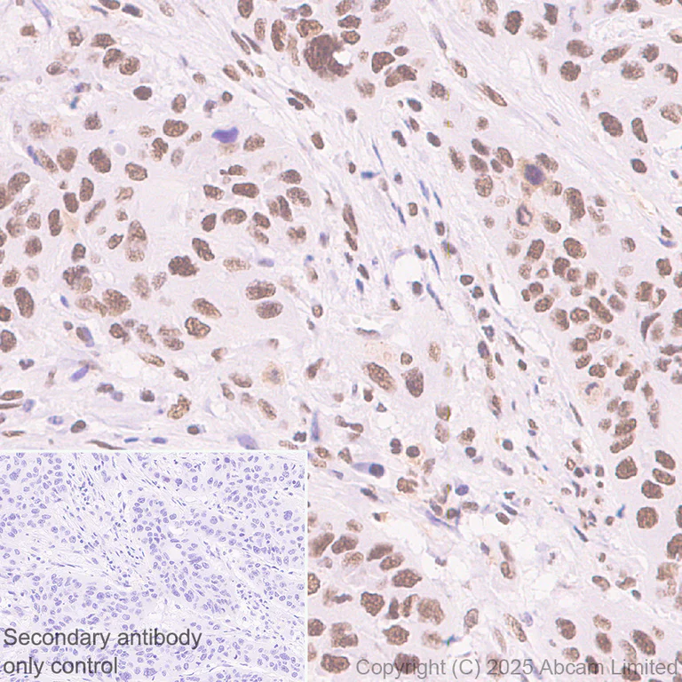 Immunohistochemistry (Formalin/PFA-fixed paraffin-embedded sections) - Anti-BRD3 antibody [EPR30249-10] (AB325539)