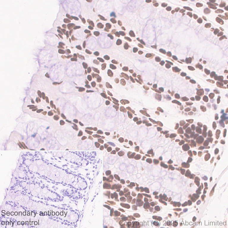 Immunohistochemistry (Formalin/PFA-fixed paraffin-embedded sections) - Anti-BRD3 antibody [EPR30249-10] (AB325539)