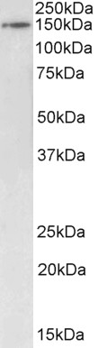 Western blot - Anti-Brd4 antibody (AB223223), expandable thumbnail