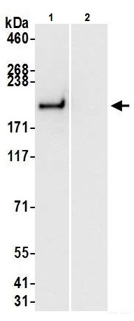 Immunoprecipitation - Anti-Brd4 antibody (AB245285), expandable thumbnail