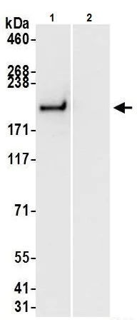 Immunoprecipitation - Anti-Brd4 antibody (AB245285)