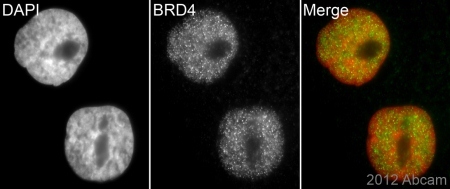 Immunocytochemistry/ Immunofluorescence - Anti-Brd4 antibody (AB75898), expandable thumbnail