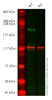 Western blot - Anti-Brd4 antibody (AB75898), expandable thumbnail