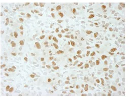 Immunohistochemistry (Formalin/PFA-fixed paraffin-embedded sections) - Anti-Brd4 antibody (AB84776)