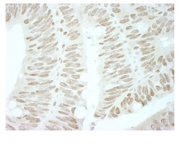Immunohistochemistry (Formalin/PFA-fixed paraffin-embedded sections) - Anti-Brd4 antibody (AB84776), expandable thumbnail