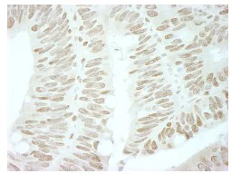 Immunohistochemistry (Formalin/PFA-fixed paraffin-embedded sections) - Anti-Brd4 antibody (AB84776)