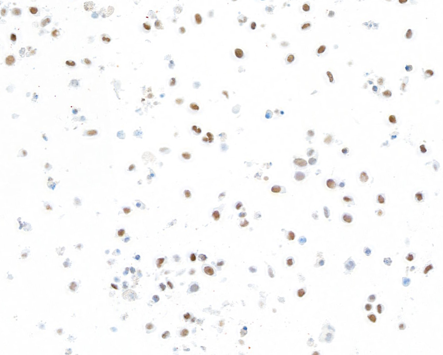 Immunocytochemistry - Anti-Brd4 antibody [BL-149-2H5] (ab243862), expandable thumbnail