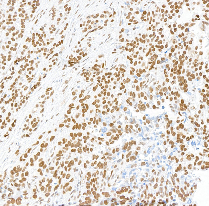 Immunohistochemistry (Formalin/PFA-fixed paraffin-embedded sections) - Anti-Brd4 antibody [BL-149-2H5] (ab243862), expandable thumbnail