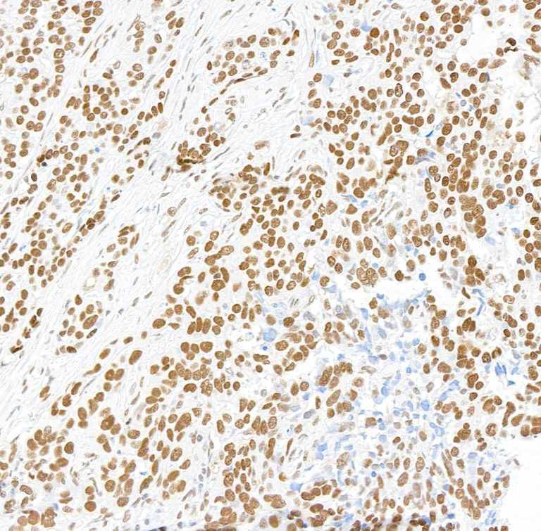 Immunohistochemistry (Formalin/PFA-fixed paraffin-embedded sections) - Anti-Brd4 antibody [BL-149-2H5] (AB243862)