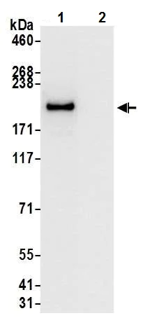 Immunoprecipitation - Anti-Brd4 antibody [BL-149-2H5] (AB243862)