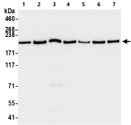 Western blot - Anti-Brd4 antibody [BL-149-2H5] (AB243862)