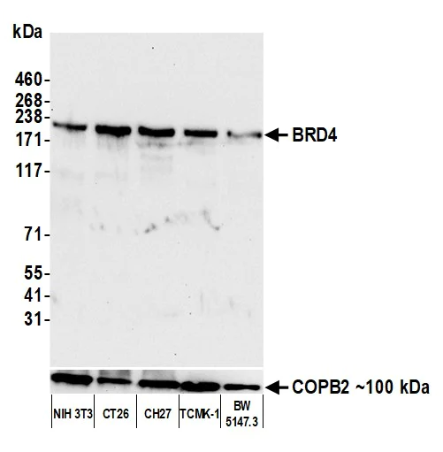 Western blot - Anti-Brd4 antibody [BL-149-2H5] (AB243862)