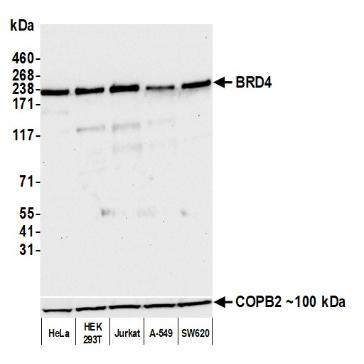 Western blot - Anti-Brd4 antibody [BL-149-2H5] (ab243862), expandable thumbnail