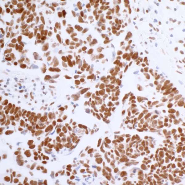 Immunohistochemistry (Formalin/PFA-fixed paraffin-embedded sections) - Anti-BRD4 antibody [BL-151-6F11] - BSA free (AB314054)