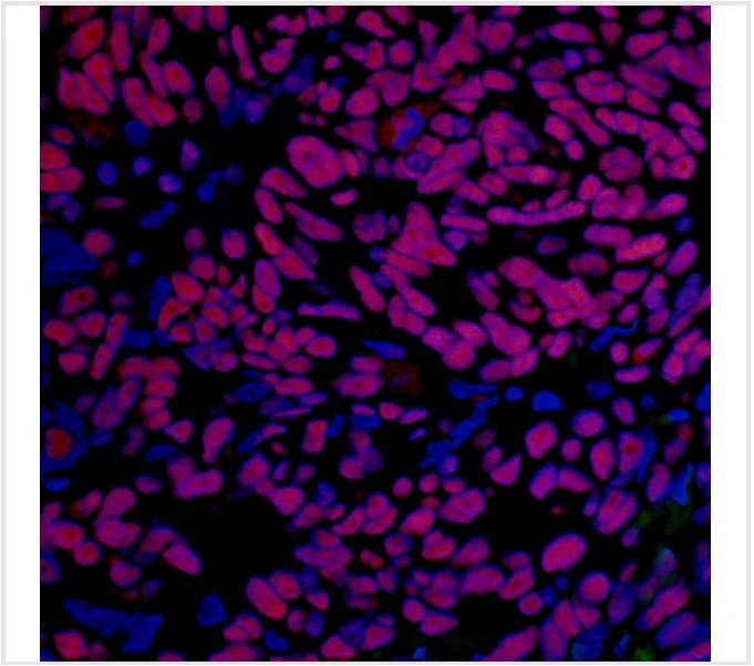 Immunohistochemistry (Formalin/PFA-fixed paraffin-embedded sections) - Anti-BRD4 antibody [BL-151-6F11] - BSA free (AB314054), expandable thumbnail