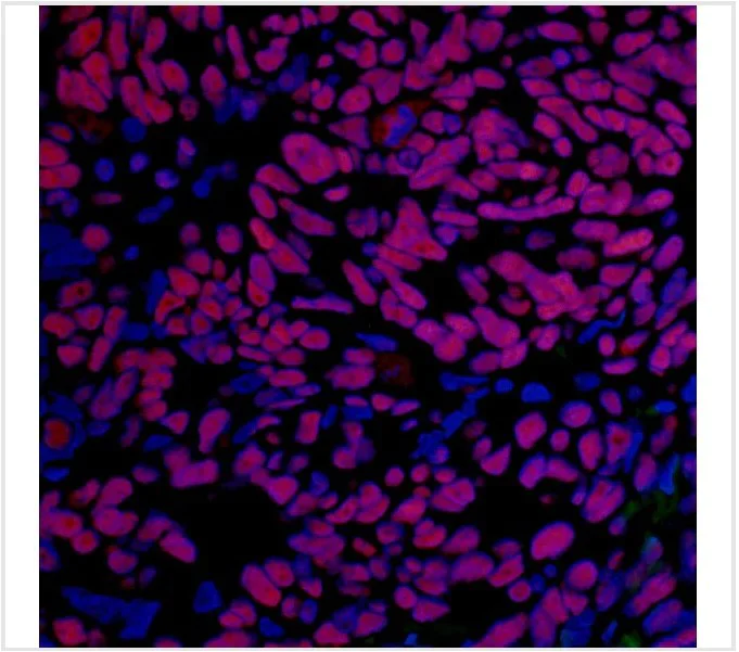 Immunohistochemistry (Formalin/PFA-fixed paraffin-embedded sections) - Anti-BRD4 antibody [BL-151-6F11] - BSA free (AB314054)