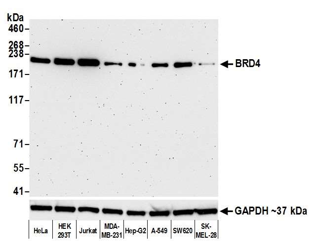 Western blot - Anti-BRD4 antibody [BL-151-6F11] - BSA free (AB314054), expandable thumbnail