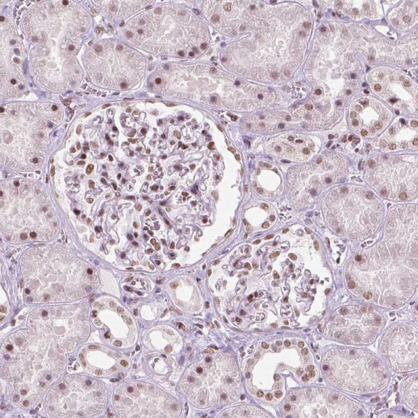 Immunohistochemistry (Formalin/PFA-fixed paraffin-embedded sections) - Anti-Brd4 antibody [CL1115] (ab244221), expandable thumbnail