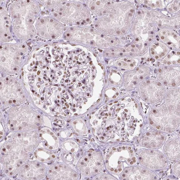 Immunohistochemistry (Formalin/PFA-fixed paraffin-embedded sections) - Anti-Brd4 antibody [CL1115] (AB244221)