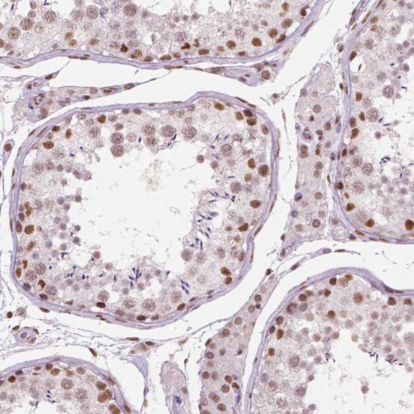 Immunohistochemistry (Formalin/PFA-fixed paraffin-embedded sections) - Anti-Brd4 antibody [CL1115] (AB244221), expandable thumbnail
