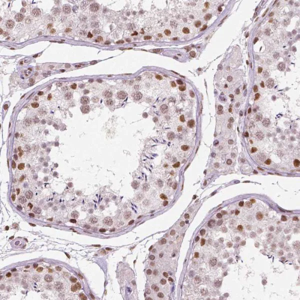 Immunohistochemistry (Formalin/PFA-fixed paraffin-embedded sections) - Anti-Brd4 antibody [CL1115] (AB244221)