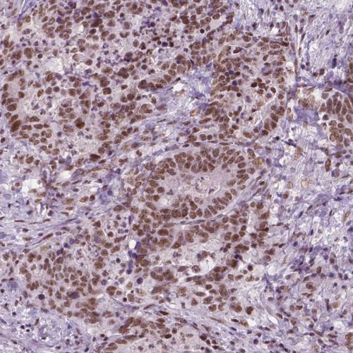Immunohistochemistry (Formalin/PFA-fixed paraffin-embedded sections) - Anti-Brd4 antibody [CL1115] (AB244221), expandable thumbnail