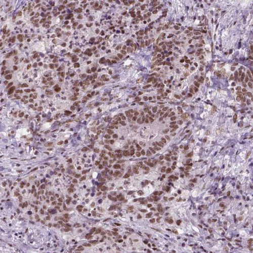 Immunohistochemistry (Formalin/PFA-fixed paraffin-embedded sections) - Anti-Brd4 antibody [CL1115] (AB244221)