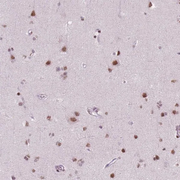 Immunohistochemistry (Formalin/PFA-fixed paraffin-embedded sections) - Anti-Brd4 antibody [CL1115] (AB244221)