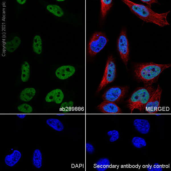 Immunocytochemistry/ Immunofluorescence - Anti-Brd4 antibody [EPR25425-23] (AB289886)