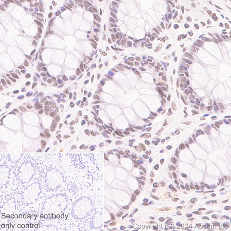 Immunohistochemistry (Formalin/PFA-fixed paraffin-embedded sections) - Anti-Brd4 antibody [EPR29186-23] (AB322063)