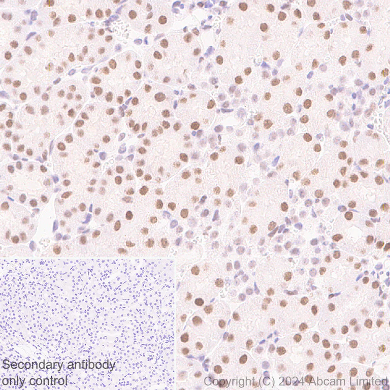Immunohistochemistry (Formalin/PFA-fixed paraffin-embedded sections) - Anti-Brd4 antibody [EPR29186-23] (AB322063)