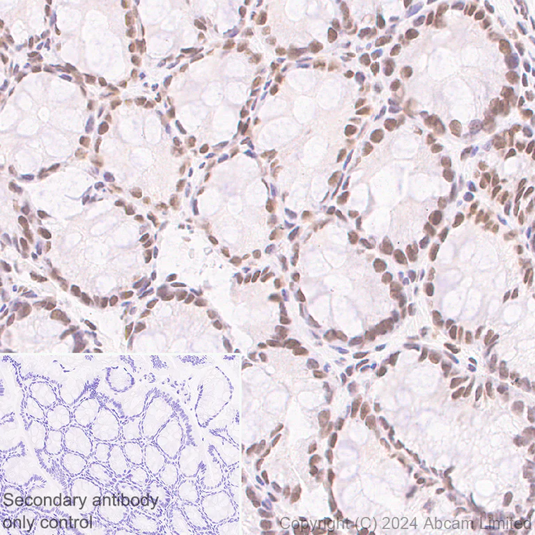 Immunohistochemistry (Formalin/PFA-fixed paraffin-embedded sections) - Anti-Brd4 antibody [EPR29186-23] (AB322063)
