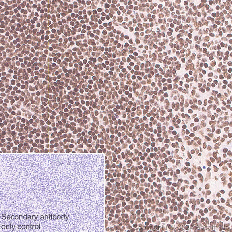Immunohistochemistry (Formalin/PFA-fixed paraffin-embedded sections) - Anti-Brd4 antibody [EPR29186-23] (AB322063)