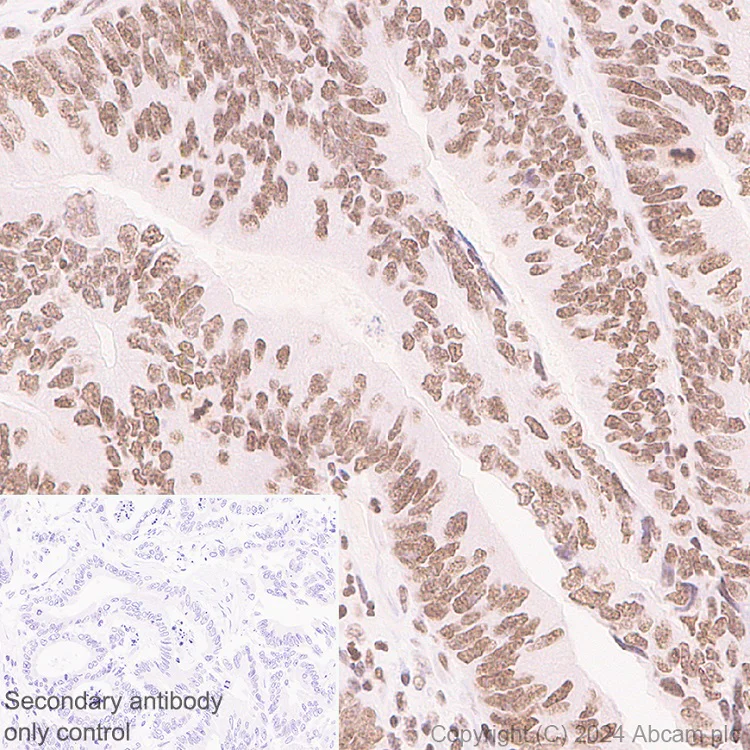 Immunohistochemistry (Formalin/PFA-fixed paraffin-embedded sections) - Anti-Brd4 antibody [EPR29186-23] (AB322063)